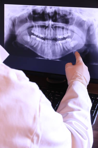 Best Emergency Tooth Extraction in Hammond, IN
