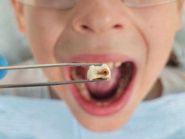 Best Pediatric Emergency Dentist in Hammond, IN